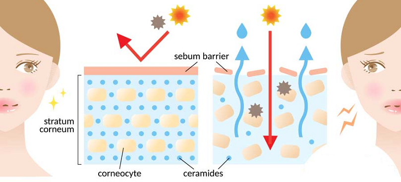 ceramides skin hydration