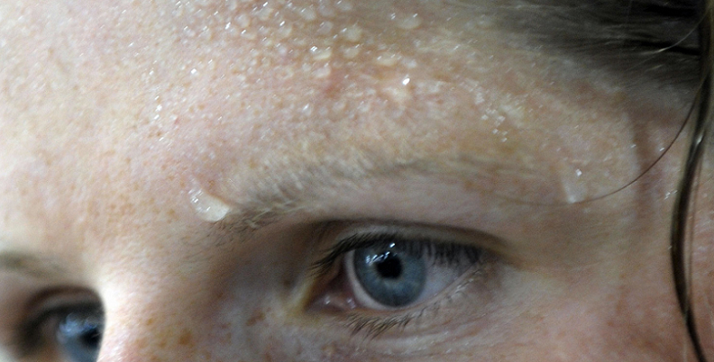 sweat skin health connection